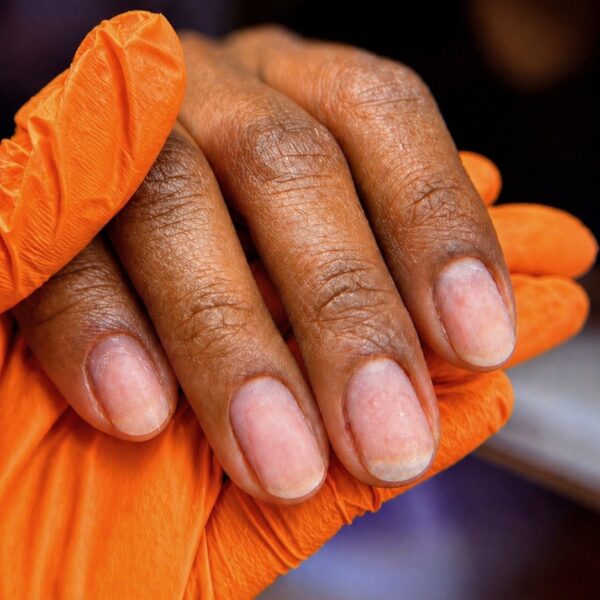 Ongle 2