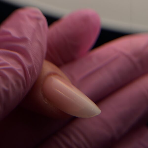 Ongle 3